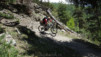 dent_sup_035